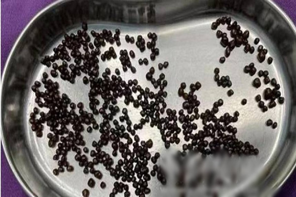 Dau bung nua nam, di kham phat hien dieu kinh di