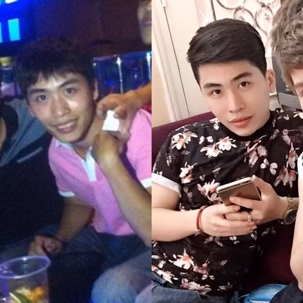 Trước đó, Như Vũ không bao giờ nghĩ đến mình sẽ "dao kéo" vì sợ đau và biến chứng để lại. Sau thời gian dài đấu tranh tư tưởng, cuối cùng Như Vũ mới dám nâng mũi.