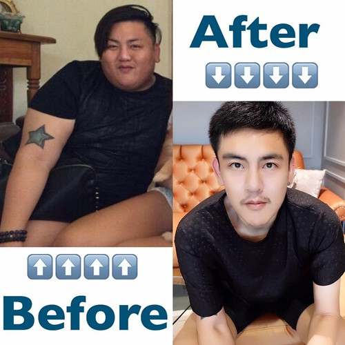 Chỉ khi sức khỏe của anh ngày một tồi tệ hơn, anh chàng mới giật mình nhận ra tác hại của việc ăn uống vô độ.