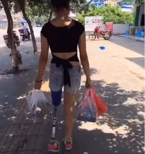 Dân mạng ngưỡng mộ trước nghị lực sống của cô gái còn trẻ mà đã phải trải qua cuộc sống không lành lặn. Câu chuyện của cô cũng trở thành nguồn động lực cho nhiều người có hoàn cảnh tương tự.