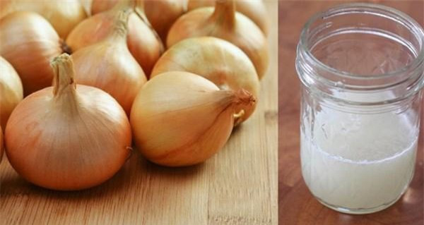 Dung dịch từ hành tây có thể giúp các chúng ta thoát ra nỗi ám ảnh "lồi lõm" khó chịu này!