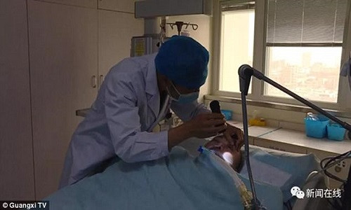 Trung Quoc: Ngu o khach san, bi ran cuc doc chui vao quan can