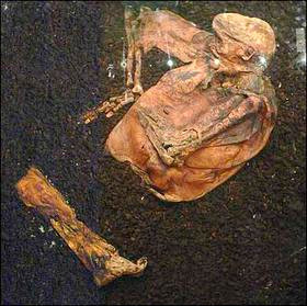 Trên xác ướp có khá nhiều vết thương nghiêm trọng bao gồm: bị bóp cổ, đánh vào đầu dẫn đến mảnh xương sọ đâm vào não. Thậm chí, trên cổ họng của người thanh niên này còn có dấu vết bị cắt. Qua đó hé lộ cái chết đầy đau đớn của người đàn ông trên.