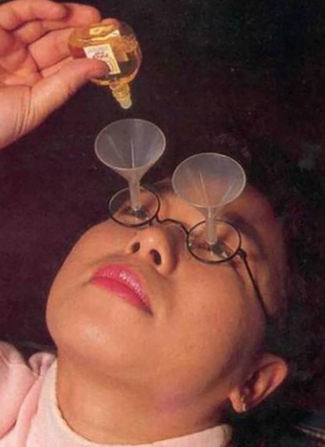 Nhờ phát minh kính ống phễu, bạn có thể nhỏ thuốc tra mắt tiện lợi hơn.