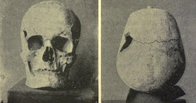 Căn cứ vào kích thước bộ hài cốt, vua Sanakht có chiều cao khoảng 187cm. Con số này lớn hơn nhiều so với người Ai Cập thời đó với chiều cao trung bình khoảng 1,6m. Theo đó, ông là đại diện cho ca bệnh khổng lồ lâu đời nhất từng được phát hiện.