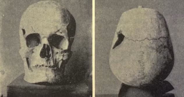 Căn cứ vào kích thước bộ hài cốt, vua Sanakht có chiều cao khoảng 187cm. Con số này lớn hơn nhiều so với người Ai Cập thời đó với chiều cao trung bình khoảng 1,6m. Theo đó, ông là đại diện cho ca bệnh khổng lồ lâu đời nhất từng được phát hiện.