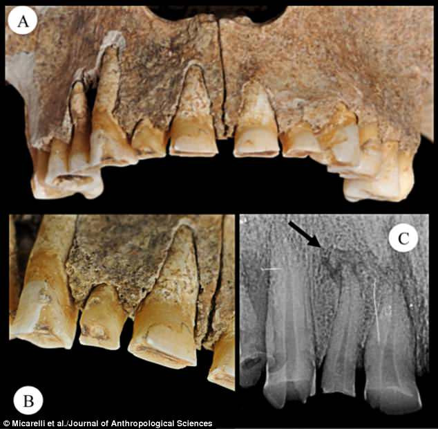 Theo các chuyên gia, người chiến binh này có thể sống ở thế kỷ 6 - 8. Vào thời điểm qua đời, người này khoảng 40 - 50 tuổi và được chôn cất cạnh một con ngựa không đầu và hàng trăm bộ hài cốt khác.