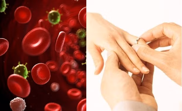 Tỷ lệ tử vong của những bệnh nhân ung thư chưa lập gia đình cao hơn so với bệnh nhân có gia đình.