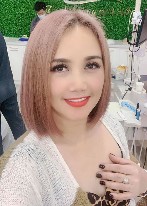 Nữ diễn viên từng bị nghi "đại phẫu" do gương mặt quá khác lạ.