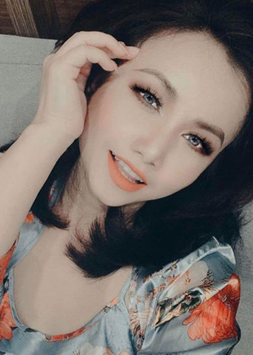 Hình ảnh Đào Hoàng Yến sau khi làm răng.