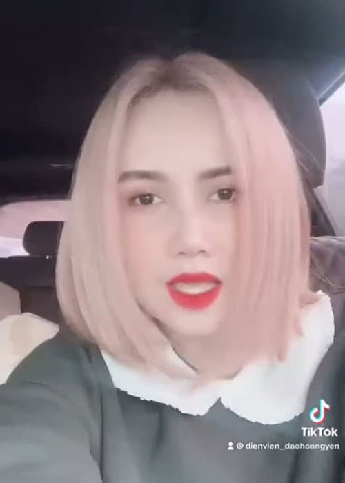 Nữ diễn viên công khai hình ảnh sau ca dao kéo. Ảnh: Công lý &amp; xã hội