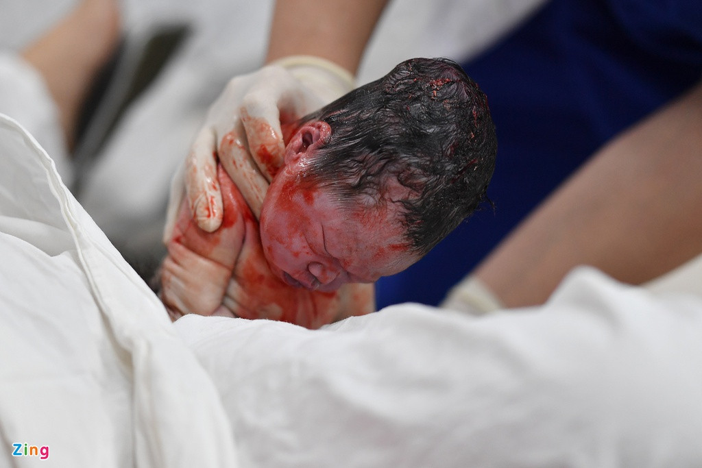 Vào thời khắc những quả pháo hoa đầu tiên trên bầu trời Hà Nội bắt đầu bắn cũng là lúc cô con gái đầu tiên của sản phụ sinh năm 2000 chào đời.