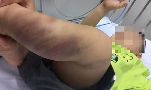 Be trai bi bao hanh duoc ve voi gia dinh ba ngoai o Ha Noi