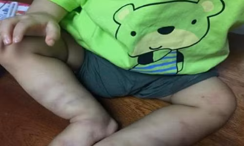 Lo danh tinh nguoi bo roi be trai bi bao hanh o vien