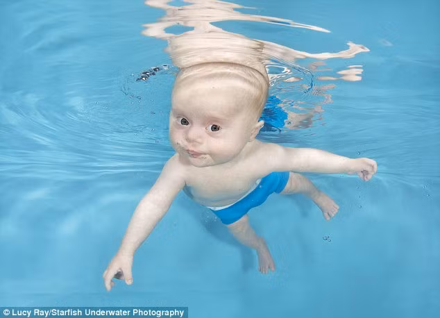 Hiện tại, bé đang ở tuần tuổi thứ 15 và đã trải qua ca phẫu thuật tim, sau khi phẫu thuật bé phải đối mặt với biến chứng tim ngừng đập, sau 4 tháng hồi phục bé đã được chuyển về nhà. 