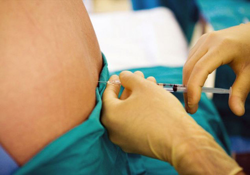 Chuyen gia tiet lo 4 dieu can biet ve sinh mo