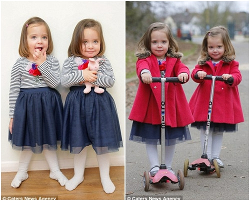 Cô Angela Formosa, mẹ của cặp song sinh, cho biết: “Các con tôi hiện tại rất khỏe mạnh và đang tăng cân. Chúng cũng như những đứa trẻ bình thường khác, thường cười và khóc khi chúng muốn điều gì đó".