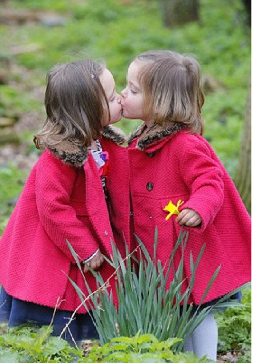 Cặp song sinh Rosie và Ruby Formosa khỏe mạnh và hồn nhiên.