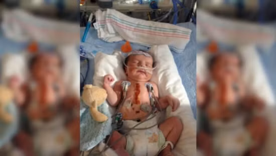 Khi sinh ra, bé Aiden được chẩn đoán mắc hội chứng suy tim trái (HLHS) phức tạp, hiếm gặp (1/6.000 trẻ đẻ sống). HLHS làm giảm hoạt động của tâm thất trái và van động mạch chủ, khiến cho phần tim bên trái hầu như không phát triển do thiếu máu. Các bác sĩ đã tiến hành tái tạo động mạch chủ và mở vách ngăn tâm nhĩ, tâm thất phải trở thành cơ quan chính bơm máu cho cơ thể bé. Ca phẫu thuật đã thành công trong niềm hạnh phúc của mọi người, cậu bé đã vượt qua một thử thách lớn mà không phải bất cứ trẻ sơ sinh nào cũng may mắn sống sót.