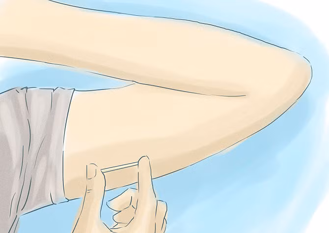 2. Sau khi được đưa vào cùng da dưới cánh tay, các que cấy sẽ phóng thích dần dần lượng hormone vào cơ thể, tạo ra tác dụng ngừa thai kéo dài có thể lên đến 5 năm.