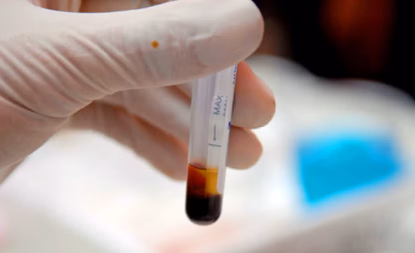 3. Xét nghiệm HIV. Để hạn chế lây nhiễm và bảo vệ mọi người trước hiểm họa HIV, một số quốc gia yêu cầu các đôi nam nữ phải kiểm tra HIV trước khi đăng ký kết hôn. Vẫn còn rất nhiều người e ngại khi đề cập đến xét nghiệm này. Thế nhưng nếu thực sự yêu nhau xét nghiệm HIV không phải phải là trở ngại lớn cho hôn nhân. Xét nghiệm này đơn giản chỉ giúp củng cố lòng tin và bảo vệ lẫn nhau mà thôi.