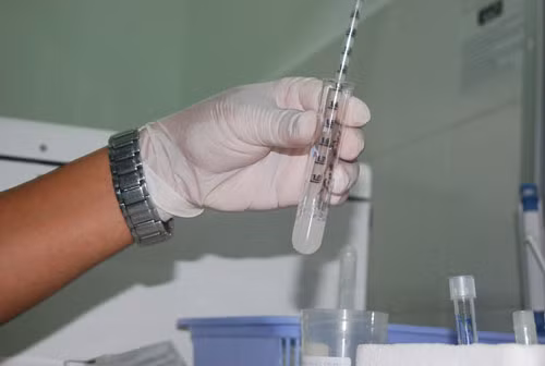 4. Xét nghiệm tinh dịch đồ. Với chú rể, việc xét nghiệm tinh dịch đồ cũng là điều quan trọng và nên làm. Đây là xét nghiệm giúp đánh giá khả năng sinh con của nam giới, nhằm giúp bạn chuẩn bị cho cuộc sống sau đám cưới. Các chú rể tương lai có thể tìm tới những phòng khám nam khoa, bệnh viện để thực hiện xét nghiệm. Trước ngày khám, chú rể nên kiêng đồ uống có cồn cũng như giữ tâm lý, sức khỏe ổn định.