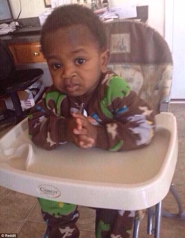 Trong khi đó, ở một vài bé tình trạng nếp nhăn trên trán là do hệ quả của việc sinh non.