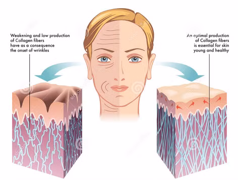 Tiến sĩ Jim Thomas, Mỹ, nhận định: kem và mặt nạ chứa collagen chỉ bám dính trên bề mặt, dễ dàng bị trôi khi tiếp xúc với chất tẩy rửa. Và khi chỉ nằm trên bề mặt thì không có tác dụng gì ngoài chức năng là một chất giữ ẩm, tức không làm thay đổi hình dạng và tính đàn hồi của da.