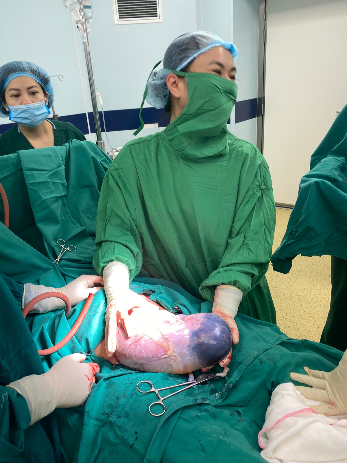 Phu Tho: Be trai song sinh chao doi con nguyen trong boc oi