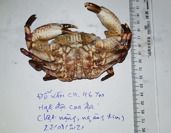 Ngu dan di bien ngung tim vi an cua mat quy-Hinh-3