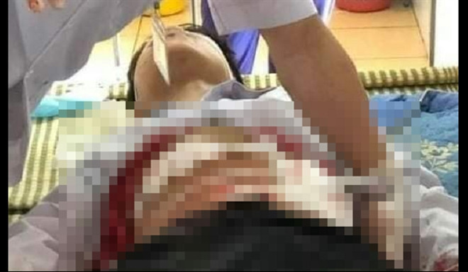 Yen Bai: Nam hoc sinh lop 9 bi ban dam guc tai cho