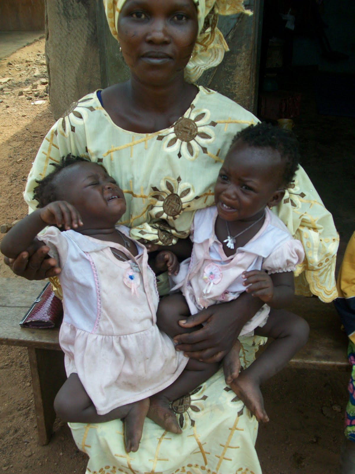 Trong khi chưa tìm ra lời giải chính xác, một số nhà nghiên cứu cho rằng nguyên nhân thị trấn Igbo-Ora có nhiều cặp sinh đôi liên quan đến thói quen ăn uống của phụ nữ.