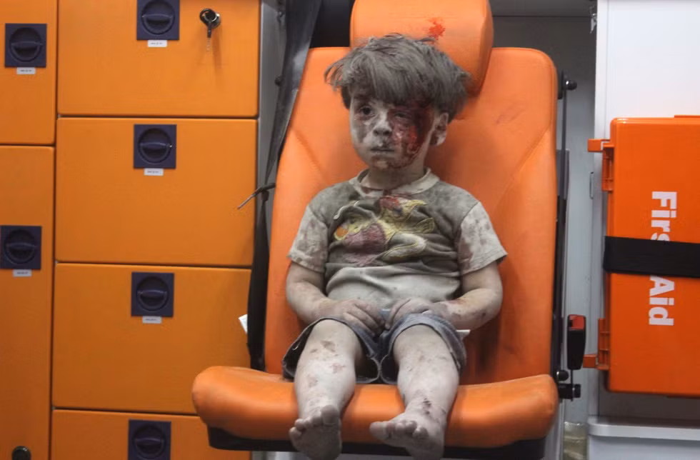 Cậu bé Omran Daqneesh dính đầy bùn đất và máu ngồi trong xe cứu thương sau một cuộc không kích ở Aleppo, Syria tháng 8/2016. Lực lượng cứu hộ mất gần 1 giờ để đào cậu bé ra ngoài từ đống đổ nát. Một cuộc không kích ở Syria phá hủy ngôi nhà của Omran sống cùng bố mẹ và hai anh chị em.