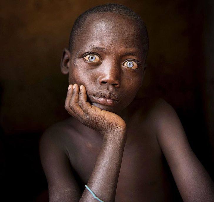 Đôi mắt đẹp của một em bé người Ethiopia.
