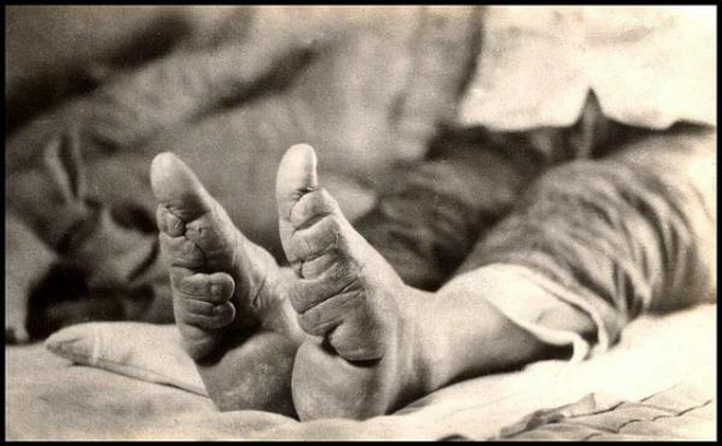 Trong lúc biểu diễn, Triệu Phi Yến để lộ đôi chân nhỏ được quấn những dải lụa. Nhà vua rất thích điệu múa và đôi chân xinh xắn của mỹ nhân này nên gọi nó là "Kim Liên Tam Thốn" (hay còn gọi gót sen ba tấc).