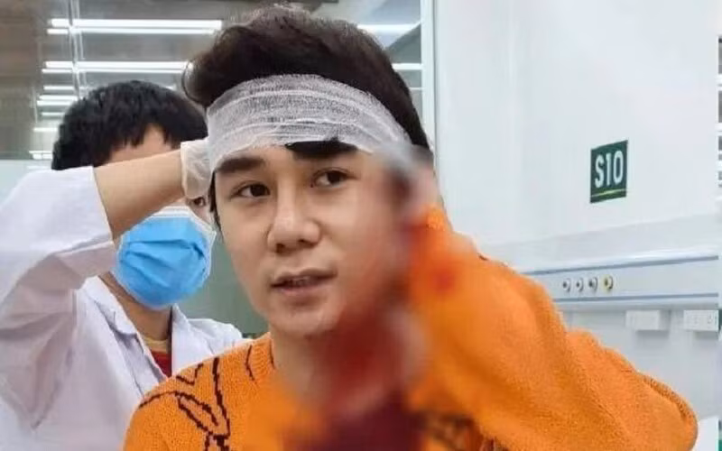 Nam dien vien bi chem o Ha Noi: Thuong tat duoi 11% xu ly the nao?-Hinh-2