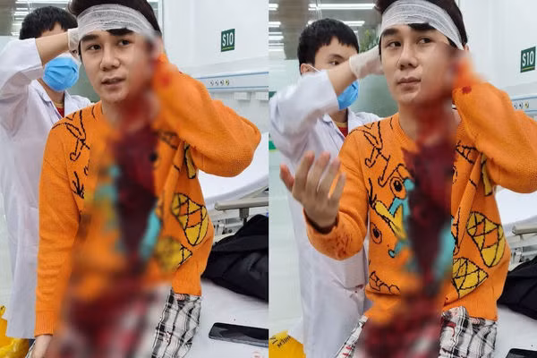 Chi tiet vu dien vien phim 