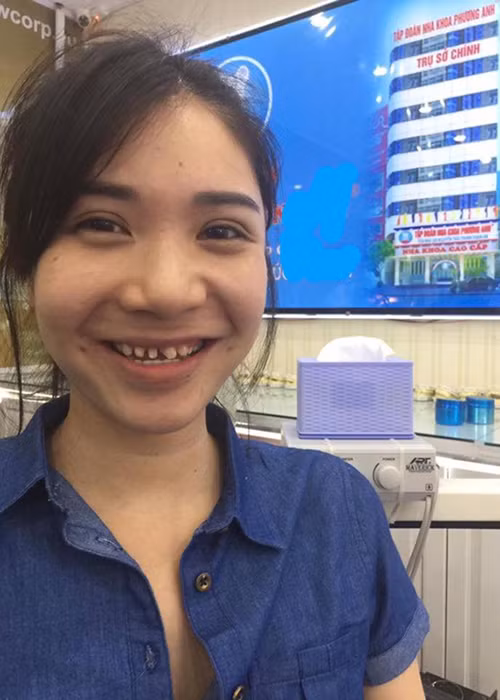 Chung minh khong xau nhung Thanh Bi lai lam khan gia soc