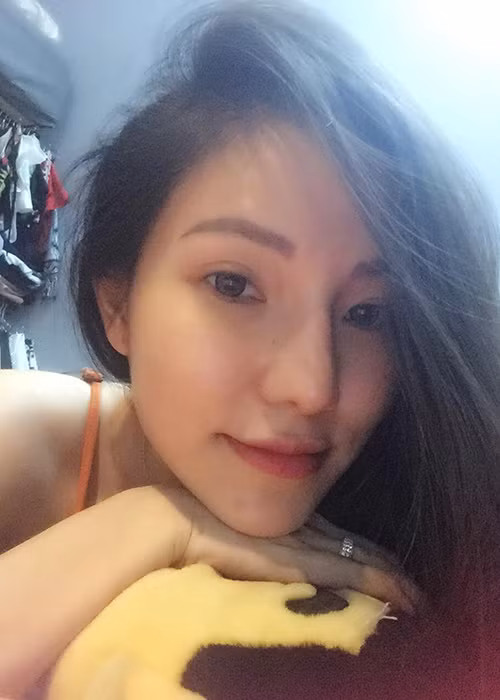 Cận gương mặt thon gọn, thanh thoát của Lý Phương Châu sau khi phẫu thuật thẩm mỹ.