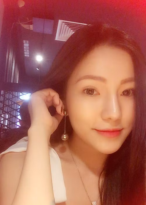 Nữ dancer sinh năm 1990 đã phẫu thuật nâng mũi và bơm môi để trở nên xinh đẹp, gợi cảm hơn.