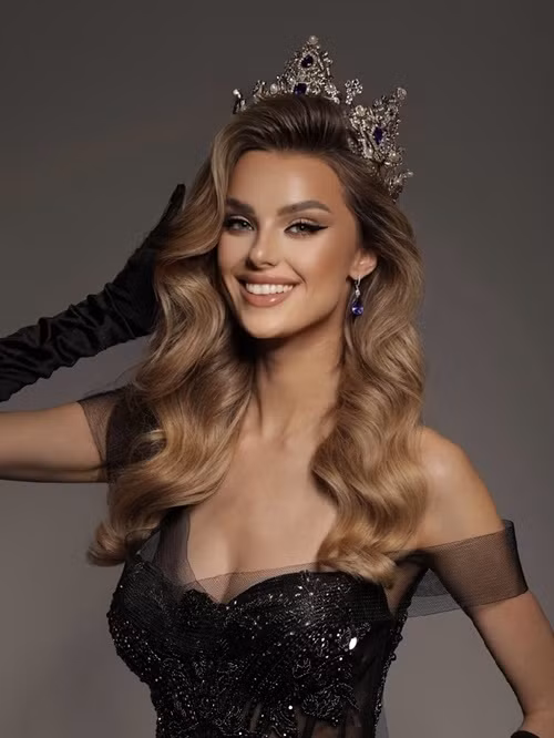 Chân dài cao 1m81, có số đo ba vòng 86-59-89 cm. Ảnh: Instagram.