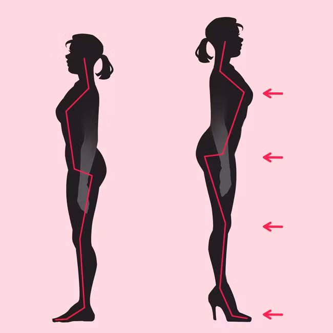 3 bộ phận cơ thể "lâm nguy" khi bạn đi giày cao gót quá nhiều 3 bo phan co the