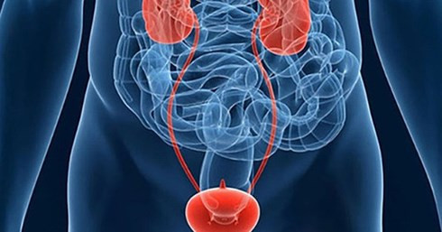 Chi vi “danh dau moc truong thanh som”, 35 tuoi da mac ung thu