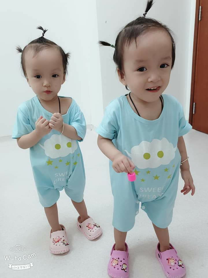 Hinh anh Truc Nhi - Dieu Nhi sau 9 thang phau thuat tach roi