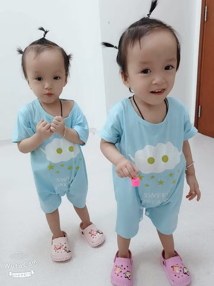 Hinh anh Truc Nhi - Dieu Nhi sau 9 thang phau thuat tach roi