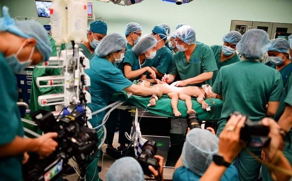Khi Trúc Nhi - Diệu Nhi được 13 tháng tuổi, cuộc mổ "lịch sử" tách rời cơ thể cho hai bé diễn ra tại Bệnh viện Nhi đồng thành phố vào ngày 15/7/2020, với hơn 90 y bác sĩ nhiều chuyên khoa. (Ảnh: Giáo dục thời đại)