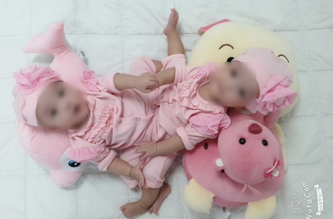 Tháng 7/2019, Bệnh viện (BV) Nhi đồng TP.HCM tiếp nhận từ BV Hùng Vương 1 trường hợp song sinh dính nhau đặc biệt. Các chuyên gia đã lên phương án chi tiết cho cuộc mổ, bao gồm cả kế hoạch xử lý những rủi ro có thể xảy khi phẫu thuật. (Ảnh: Giáo dục thời đại)