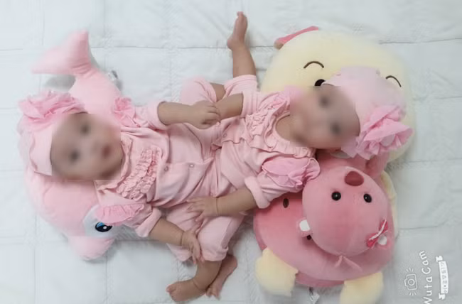 Tháng 7/2019, Bệnh viện (BV) Nhi đồng TP.HCM tiếp nhận từ BV Hùng Vương 1 trường hợp song sinh dính nhau đặc biệt. Các chuyên gia đã lên phương án chi tiết cho cuộc mổ, bao gồm cả kế hoạch xử lý những rủi ro có thể xảy khi phẫu thuật. (Ảnh: Giáo dục thời đại)