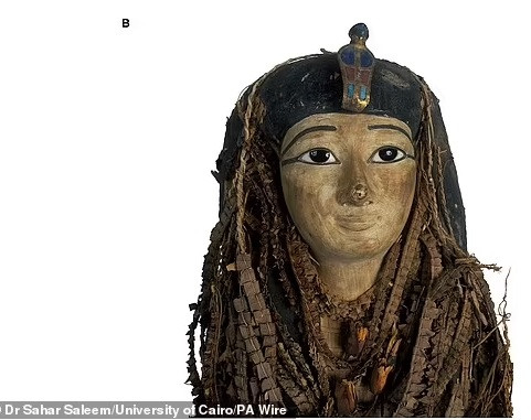 Kỹ thuật khác mà ông Morares dùng mang tên biến dạng giải phẫu, trong đó mô hình tái tạo kỹ thuật số phần đầu của người hiến tặng được điều chỉnh cho tới khi khớp với hộp sọ của pharaoh Amenhotep I.