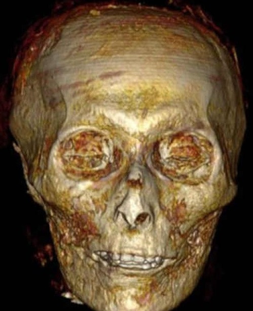 Pharaoh Amenhotep I đạt được nhiều thành tựu quân sự, bao gồm các chiến dịch thành công ở vùng đất ngày nay là Libya và miền bắc Sudan. Ông cũng cho xây dựng nhiều công trình kiến trúc, tôn giáo và nhận được sự kính trọng của người dân. Sau khi qua đời khoảng 35 tuổi, Amenhotep I được tôn thờ như một vị thần. Xác ướp của ông được bảo quản cẩn thận. Ông là pharaoh đầu tiên được chôn cất ở Thung lũng các vị vua.